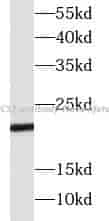 SOCS1 antibody - Click Image to Close