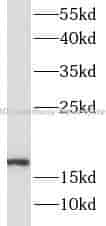 SOD1 antibody - Click Image to Close