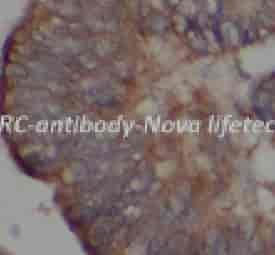 SRC antibody - Click Image to Close