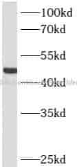 ST6GAL1 antibody - Click Image to Close