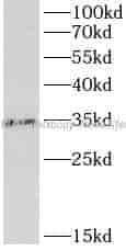 SULT1A1 antibody - Click Image to Close