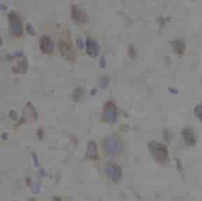 TAB2 antibody - Click Image to Close