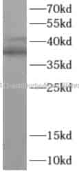 TAL1 antibody - Click Image to Close