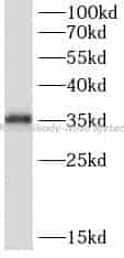 TK2 antibody - Click Image to Close