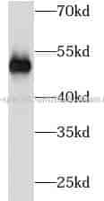 TUBB3 specific antibody - Click Image to Close