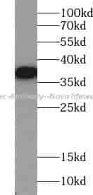 Tec Antibody - Click Image to Close