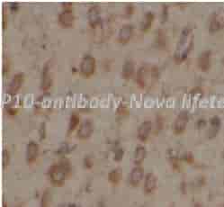 USP10 antibody - Click Image to Close