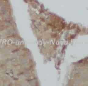 UTRO antibody - Click Image to Close