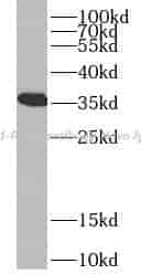 VDAC1/Porin antibody - Click Image to Close
