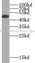 VEGFC antibody - Click Image to Close