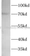 WEE1 antibody - Click Image to Close