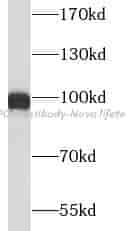 XPOT antibody - Click Image to Close