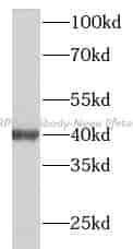 XRP2 antibody - Click Image to Close