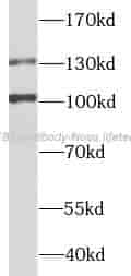 ZEB2 antibody - Click Image to Close