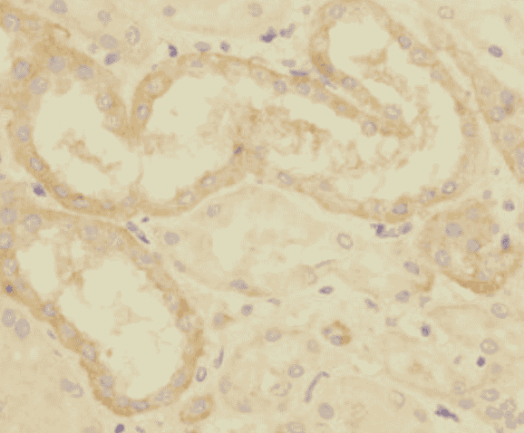 Anti-CRLF2 antibody - Click Image to Close