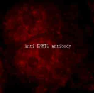 Anti-DNMT1 antibody