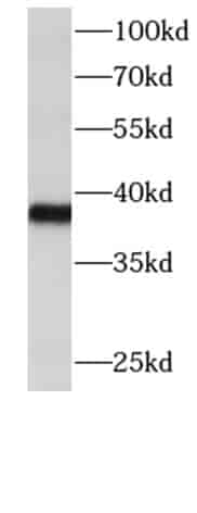 Anti-DTX3 antibody