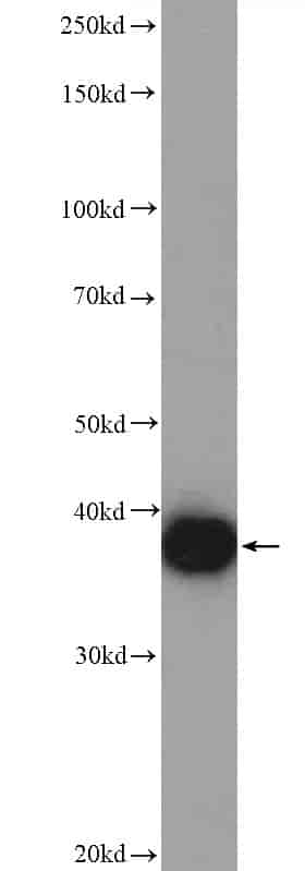 Anti-EBP2 antibody - Click Image to Close