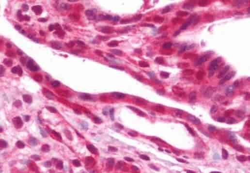 Anti-EIF5A2 antibody - Click Image to Close