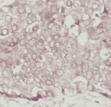Anti-EPCAM antibody - Click Image to Close