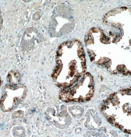 Anti-EXOSC9 antibody - Click Image to Close