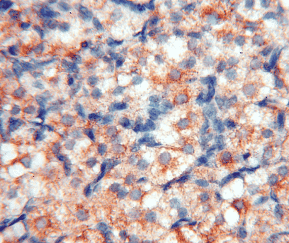 Anti-FABP3 antibody - Click Image to Close