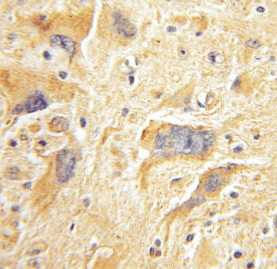 Anti-FAK antibody - Click Image to Close
