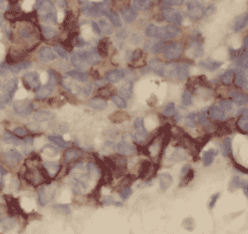 Anti-FGFR1 antibody - Click Image to Close