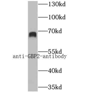 Anti-GBP2 antibody - Click Image to Close