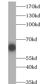 Anti-GFP tag antibody - Click Image to Close