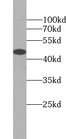 Anti-GST Tag antibody - Click Image to Close