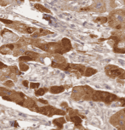 Anti-GSTO1 antibody - Click Image to Close