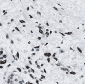 Anti-HDAC1 antibody - Click Image to Close