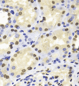 Anti-HDGF antibody - Click Image to Close
