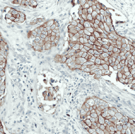 Anti-HER2/ErbB2 antibody - Click Image to Close