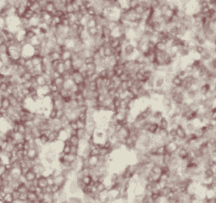 Anti-HLA class I (HLA-A) antibody - Click Image to Close