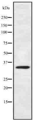 Anti-HOXC11 antibody - Click Image to Close