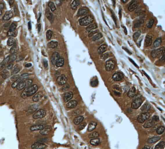 PTPRN antibody - Click Image to Close