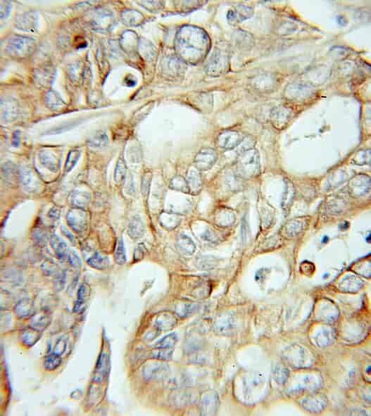 Anti-IA-2/PTPRN antibody - Click Image to Close