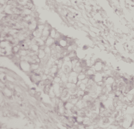 Anti-ICAM-1 antibody - Click Image to Close