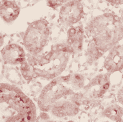 Anti-IFT88 antibody - Click Image to Close