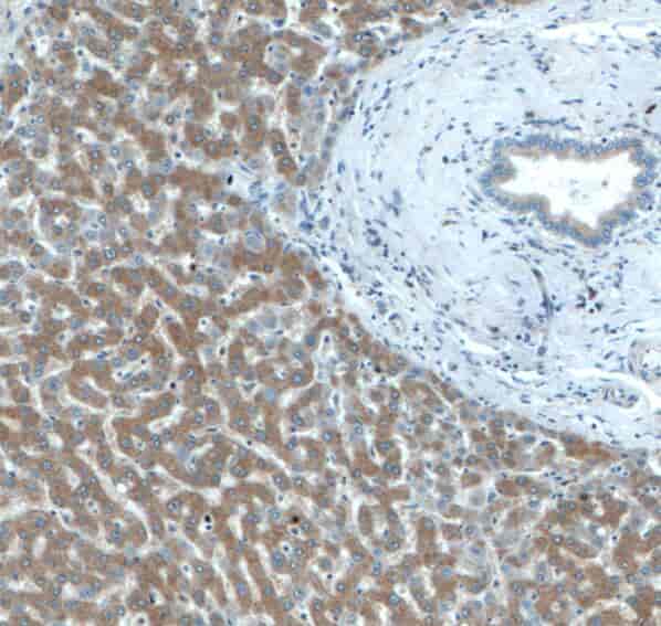 Anti-IIP45 antibody - Click Image to Close