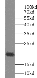 Anti-IL-17 antibody - Click Image to Close