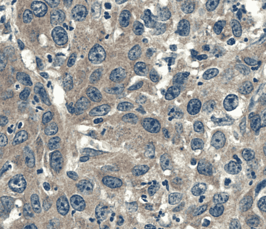 Anti-IL-6 antibody - Click Image to Close