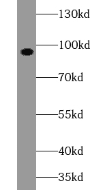Anti-IL17RA antibody - Click Image to Close