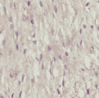 Anti-IL2 antibody - Click Image to Close