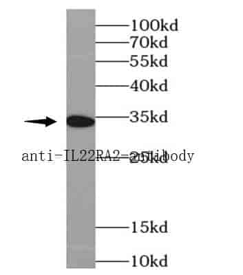 Anti-IL22RA2 antibody - Click Image to Close
