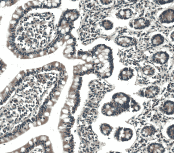 Anti-IL31 antibody - Click Image to Close