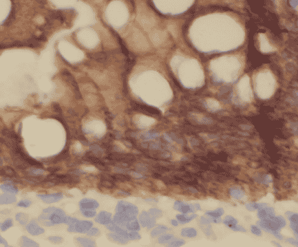Anti-IL37 antibody - Click Image to Close