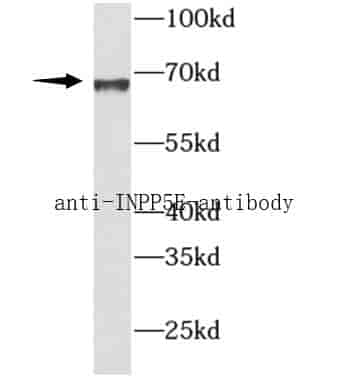 Anti-INPP5E antibody - Click Image to Close